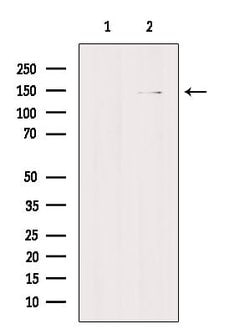 Invitrogen TEM5 Polyclonal Antibody 100 &mu;L; Unconjugated:Antibodies,