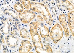 GPR139 Polyclonal Antibody:Antibodies, Polyclonal
