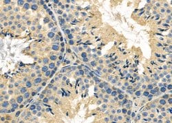 GPR139 Polyclonal Antibody:Antibodies, Polyclonal