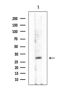 Invitrogen GPR40 Polyclonal Antibody 100 &mu;L | Buy Online | Invitrogen&trade; | Fisher Scientific