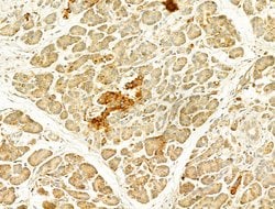 Invitrogen GZMB/GZMH Polyclonal Antibody 100 &mu;L; Unconjugated:Antibodies,