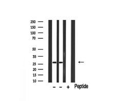 Invitrogen GZMB/GZMH Polyclonal Antibody 100 &mu;L; Unconjugated:Antibodies,