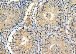 Invitrogen™ GRID2 Polyclonal Antibody