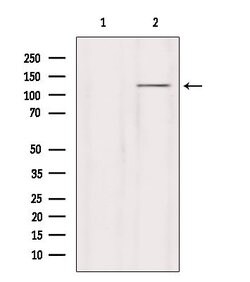 Invitrogen GRID2 Polyclonal Antibody 100 &mu;L | Buy Online | Invitrogen&trade; | Fisher Scientific