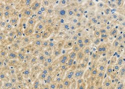 Invitrogen GTPBP1 Polyclonal Antibody 100 &mu;L | Buy Online | Invitrogen&trade; | Fisher Scientific