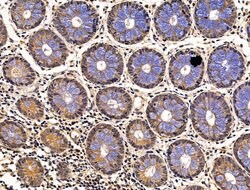 Invitrogen GUCY1A2 Polyclonal Antibody 100 &mu;L; Unconjugated:Antibodies,