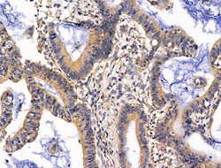 Invitrogen GUCY1A2 Polyclonal Antibody 100 &mu;L; Unconjugated:Antibodies,