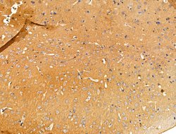 Invitrogen GUCY1A2 Polyclonal Antibody 100 &mu;L; Unconjugated:Antibodies,