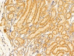 Invitrogen GUCY1A2 Polyclonal Antibody 100 &mu;L; Unconjugated:Antibodies,