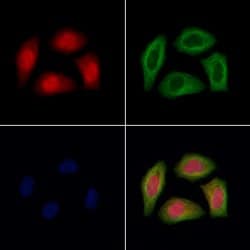 Invitrogen TNRC6A Polyclonal Antibody 100 &mu;L; Unconjugated:Antibodies,