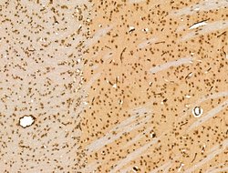 Invitrogen TNRC6A Polyclonal Antibody 100 &mu;L; Unconjugated:Antibodies,
