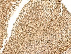 Invitrogen TNRC6A Polyclonal Antibody 100 &mu;L; Unconjugated:Antibodies,