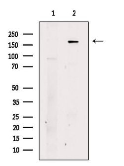 Invitrogen TNRC6A Polyclonal Antibody 100 &mu;L; Unconjugated:Antibodies,