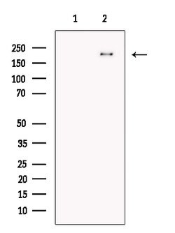 Invitrogen TNRC6A Polyclonal Antibody 100 &mu;L; Unconjugated:Antibodies,