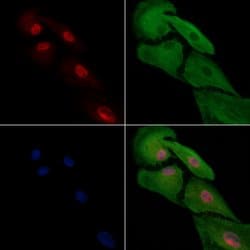Invitrogen HAND2 Polyclonal Antibody 100 &mu;L; Unconjugated:Antibodies,