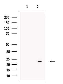 Invitrogen HAND2 Polyclonal Antibody 100 &mu;L; Unconjugated:Antibodies,