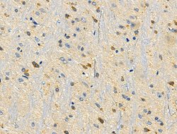 Invitrogen HAPLN1 Polyclonal Antibody 100 &mu;L | Buy Online | Invitrogen&trade; | Fisher Scientific