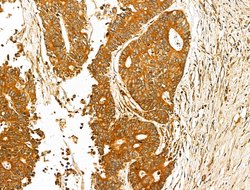 Invitrogen USH1C Polyclonal Antibody 100 &mu;L; Unconjugated:Antibodies,