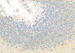 Invitrogen HECW1 Polyclonal Antibody 100 &mu;L; Unconjugated:Antibodies,