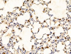 Invitrogen HBB Polyclonal Antibody 100 &mu;L; Unconjugated:Antibodies,