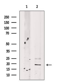 Invitrogen HBB Polyclonal Antibody 100 &mu;L; Unconjugated:Antibodies,
