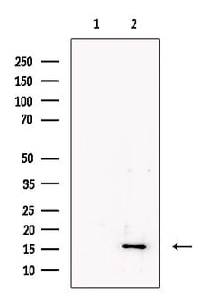 Invitrogen HBB Polyclonal Antibody 100 &mu;L; Unconjugated:Antibodies,