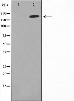 Invitrogen ErbB2 (HER-2) Polyclonal Antibody 100 &mu;L; Unconjugated:Antibodies,