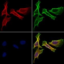 Invitrogen HHIP Polyclonal Antibody 100 &mu;L; Unconjugated:Antibodies,