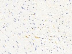 Invitrogen HHIP Polyclonal Antibody 100 &mu;L; Unconjugated:Antibodies,