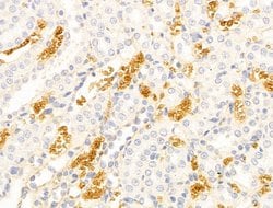 Invitrogen HHIP Polyclonal Antibody 100 &mu;L; Unconjugated:Antibodies,