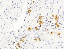 Invitrogen HHIP Polyclonal Antibody 100 &mu;L; Unconjugated:Antibodies,