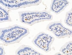Invitrogen HHIP Polyclonal Antibody 100 &mu;L; Unconjugated:Antibodies,