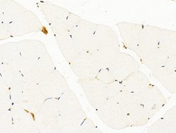 Invitrogen HHIP Polyclonal Antibody 100 &mu;L; Unconjugated:Antibodies,