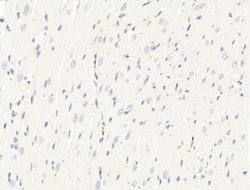 Invitrogen HHIP Polyclonal Antibody 100 &mu;L; Unconjugated:Antibodies,