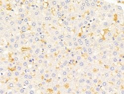 Invitrogen HHIP Polyclonal Antibody 100 &mu;L; Unconjugated:Antibodies,