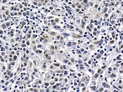 Invitrogen HIPK1 Polyclonal Antibody 100 &mu;L; Unconjugated:Antibodies,