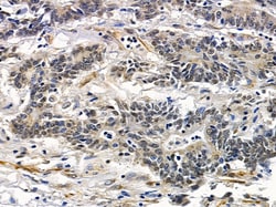 Invitrogen HIPK1 Polyclonal Antibody 100 &mu;L; Unconjugated:Antibodies,