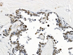 Invitrogen HIPK1 Polyclonal Antibody 100 &mu;L; Unconjugated:Antibodies,