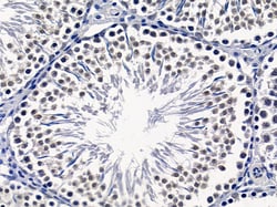 Invitrogen HIPK1 Polyclonal Antibody 100 &mu;L; Unconjugated:Antibodies,