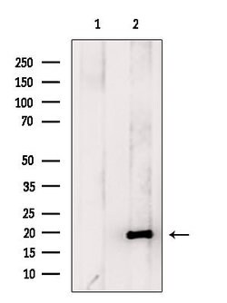 Invitrogen Hippocalcin Polyclonal Antibody 100 &mu;L; Unconjugated:Antibodies,