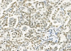 Invitrogen HKR1 Polyclonal Antibody 100 &mu;L; Unconjugated:Antibodies,