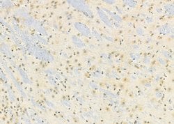Invitrogen HKR1 Polyclonal Antibody 100 &mu;L; Unconjugated:Antibodies,