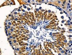 Invitrogen HLA-ABC Polyclonal Antibody 100 &mu;L | Buy Online | Invitrogen&trade; | Fisher Scientific