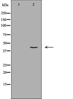 Invitrogen HLA-ABC Polyclonal Antibody 100 &mu;L | Buy Online | Invitrogen&trade; | Fisher Scientific