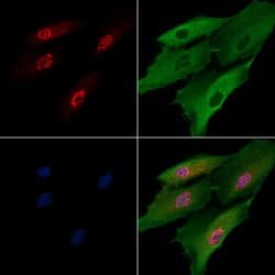 Invitrogen HLTF Polyclonal Antibody 100 &mu;L; Unconjugated:Antibodies,