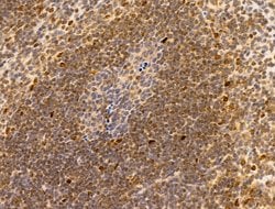 Invitrogen HMGA1 Polyclonal Antibody 100 &mu;L; Unconjugated:Antibodies,