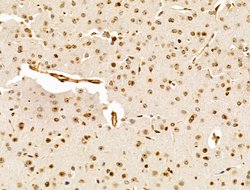 Invitrogen HMGA1 Polyclonal Antibody 100 &mu;L; Unconjugated:Antibodies,