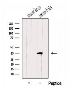 Invitrogen HMGCL Polyclonal Antibody 100 &mu;L; Unconjugated:Antibodies,