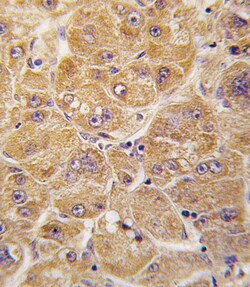 Invitrogen ALDH1A1 Polyclonal Antibody 400 &mu;L; Unconjugated:Antibodies,