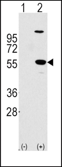 Invitrogen ALDH1A1 Polyclonal Antibody 400 &mu;L; Unconjugated:Antibodies,